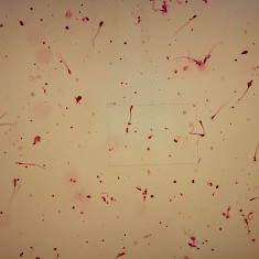 医院生殖科精子精液常规显微检查