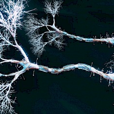 称为树突的分支状投影可以帮助神经元执行复杂的计算